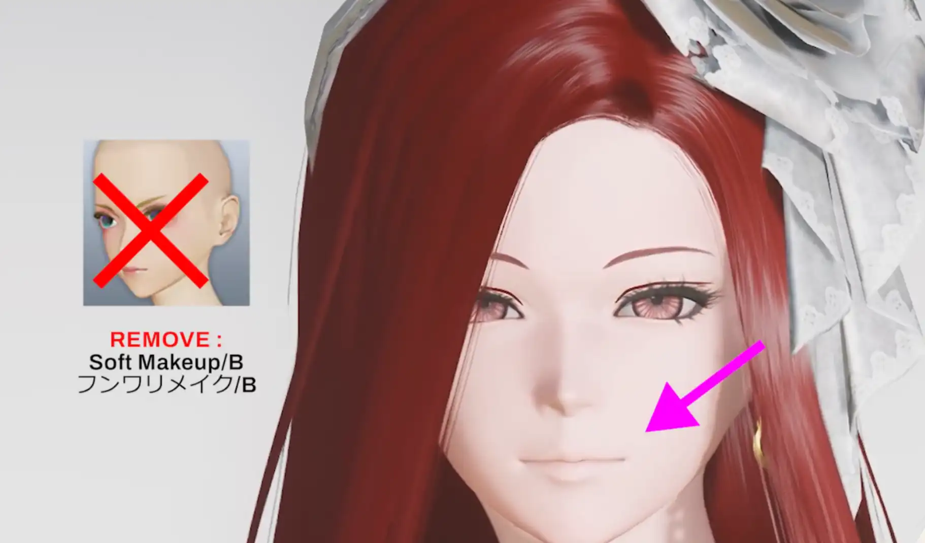 After Remove